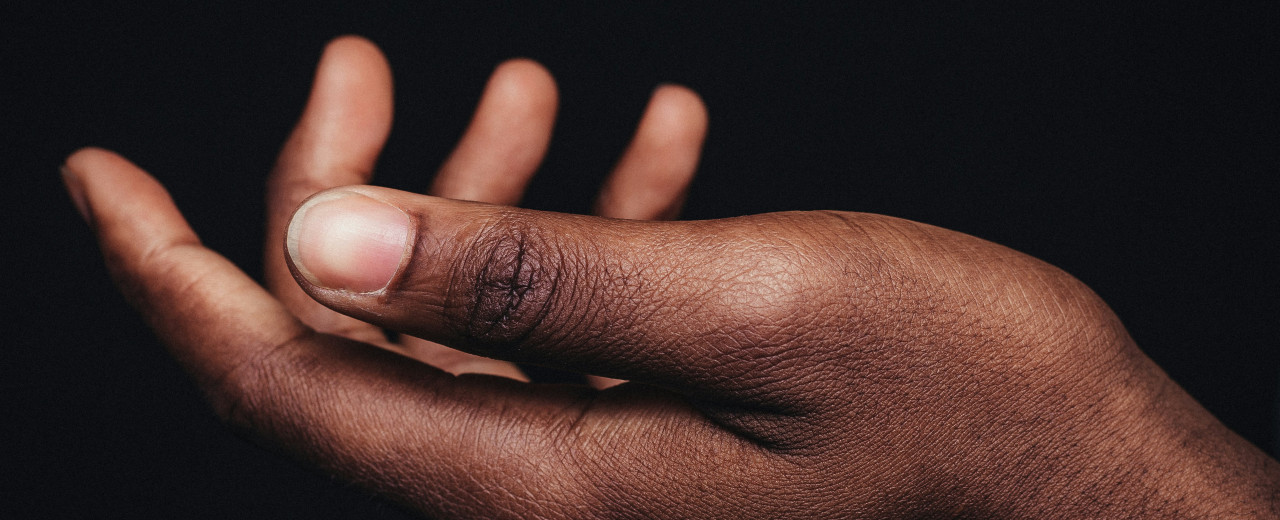 Заусенцы на пальцах: как избавиться и как профилактировать